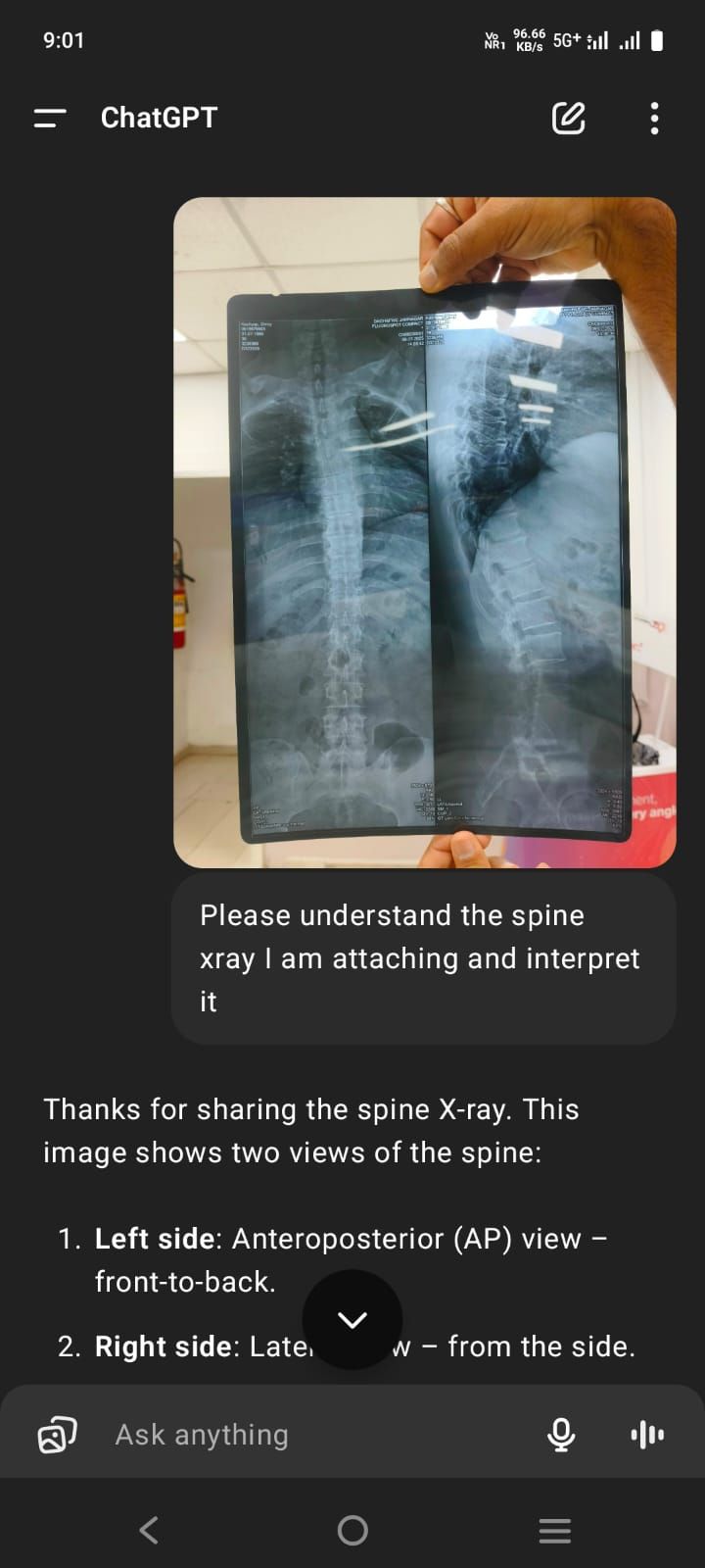 How I Used ChatGPT to Decode My X-Ray